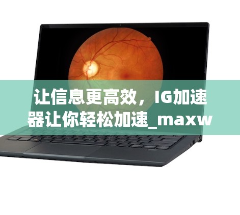 让信息更高效,IG加速器让你轻松加速_maxwell 让信息更高效,IG加速器让你轻松加速_maxwell